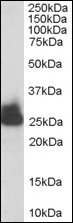 AP08894PU-N - Triosephosphate isomerase (TPI1)
