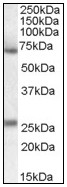 AP08983PU-N - Alpha-2-antiplasmin / SERPINF2