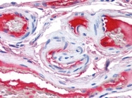 AP08914PU-N - Coagulation factor XII (F12)
