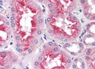 AP08913PU-N - SMAD9