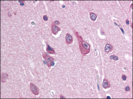 AP08900PU-N - SCN2B