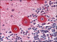 AP08902PU-N - IP3 receptor 1 / ITPR1