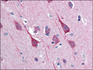 AP08905PU-N - DISC1