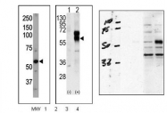 AP14608PU-N - ACVRL1 / ALK1