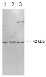 AP09076SU-N - ERK2