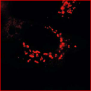 AP09091SU-N - SARS M