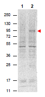 AM08449PU-N - STAT5 / STAT5A