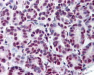 AM08449PU-N - STAT5 / STAT5A