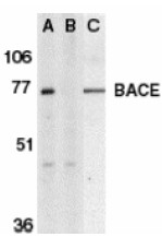 AP09144PU-N - BACE1