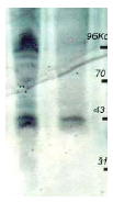 AP09225PU-N - Phosphothreonine