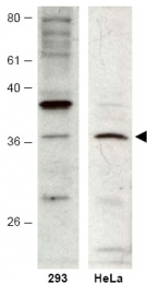 AP09244PU-N - HUS1B