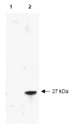 AP09229PU-N - RFP-Tag