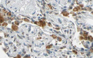 AP09246PU-N - XRCC9 / FANCG