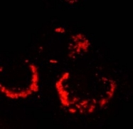 AP09090SU-N - SARS ORF1ab polyprotein