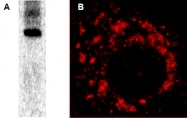 AP09089SU-N - SARS ORF1ab polyprotein