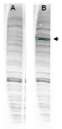 AP09250PU-N - ATPase WRNIP1