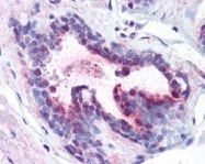 AP09344PU-N - PDCD4