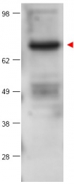 AP09394PU-N - PRKCB