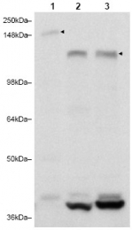 AP09361PU-N - RAB11FIP3
