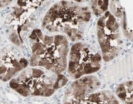 AP09295PU-N - CBLC / RNF57