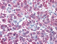 AP09295PU-N - CBLC / RNF57