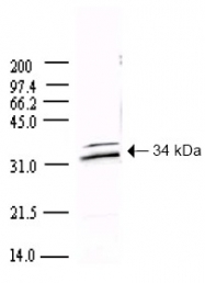 AP09152PU-N - SARS ORF1ab polyprotein