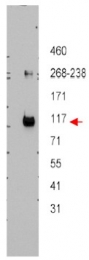 AP09395PU-N - ABCB5