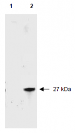 AP09229BT-N - RFP-Tag