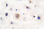 AP06070PU-N - GJA1 / Cx43