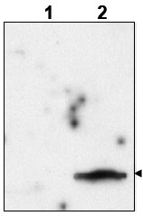 AP09359PU-N - FIV p15 gag