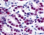 AP09288PU-N - HDAC1