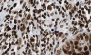 AP09288PU-N - HDAC1
