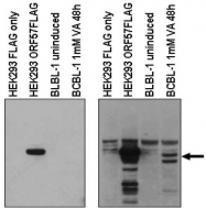 AP09401PU-N - Herpes Virus Type 8 / HHV8