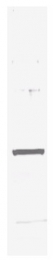 R1181B - 6xHistidine Epitope Tag