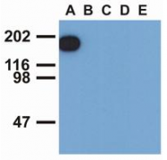 AM12001PU-N - EGFR / ERBB1