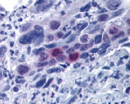 AP09322PU-N - MLF1IP