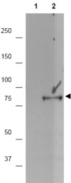 AP09419PU-N - RPS6KA1
