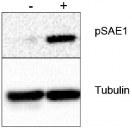 AP09416PU-N - SAE1 / AOS1