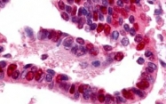 AP09131PU-N - UBE1 / UBA1