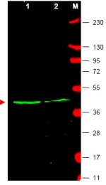 AP09374PU-N - WNT1