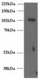 AP16242PU-N - UNC13D