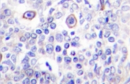 AP06784PU-N - CD83
