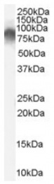 AP16513PU-N - Radixin / RDX