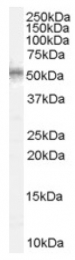AP16519PU-N - WT1 / Wilms tumor protein