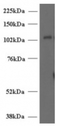 AP16521PU-N - UNC13D