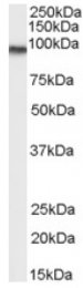 AP16591PU-N - Transglutaminase-2 (TGM2)