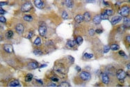 AP06201PU-N - Cytokeratin 19