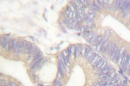 AP06321PU-N - Somatostatin / SST