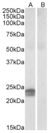 AP09439PU-N - HMGA1 / HMGIY