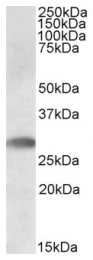 AP09448PU-N - TREML1